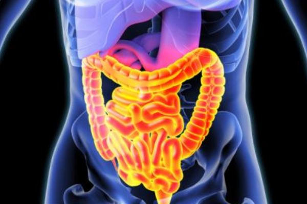 Intestino infiammato