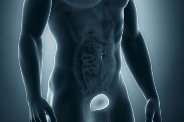 Varicocele sintomi e cause