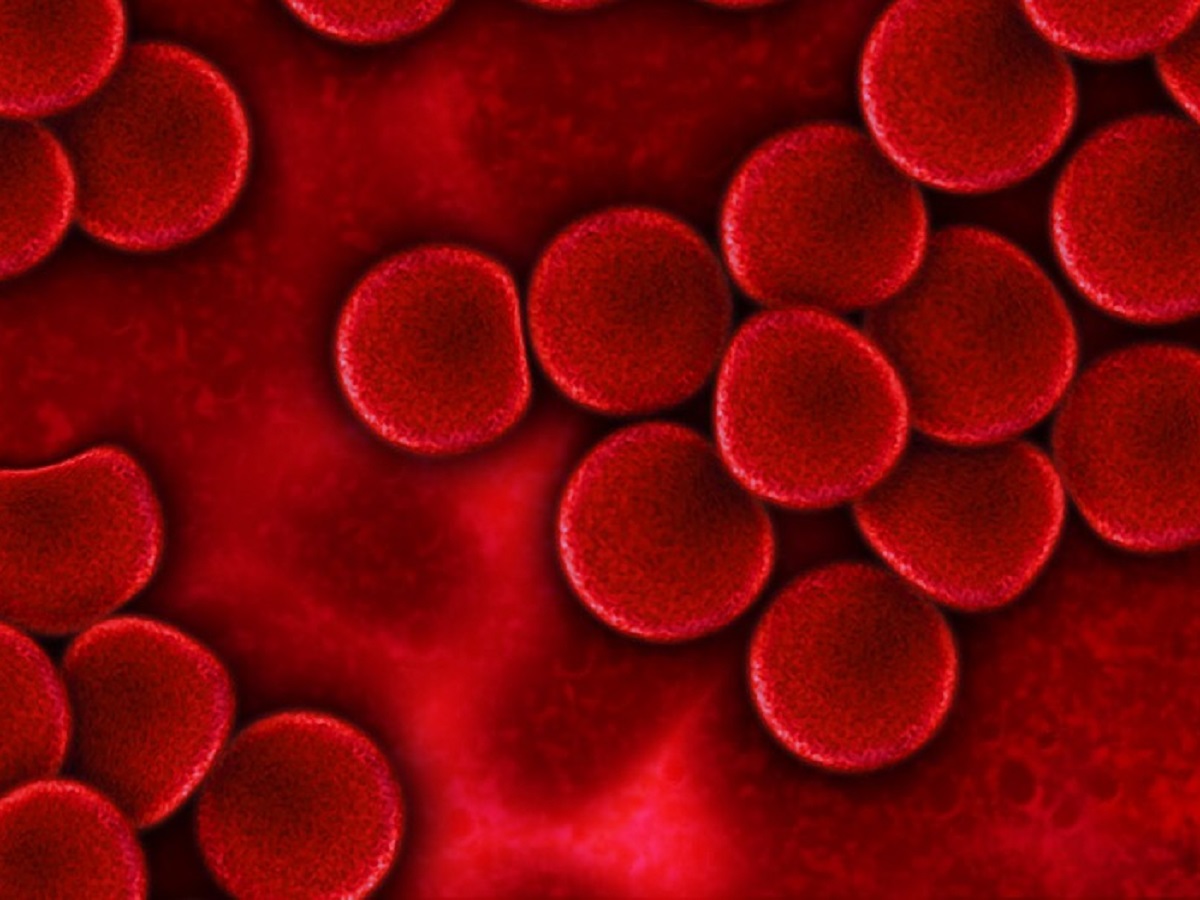 alfa talassemia